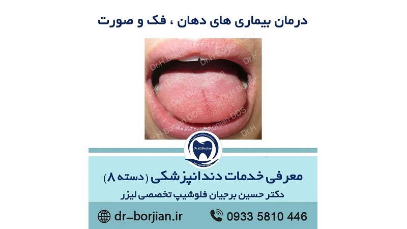 دسته هشتم : درمان بیماری های دهان، فک و صورت