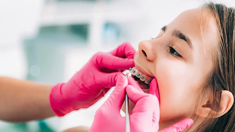 تسریع درمان ارتودنسی با کمک لیزر