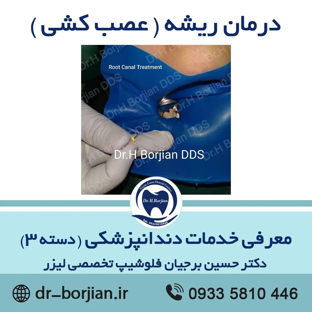 معرفی خدمات دندانپزشکی (دسته 3)