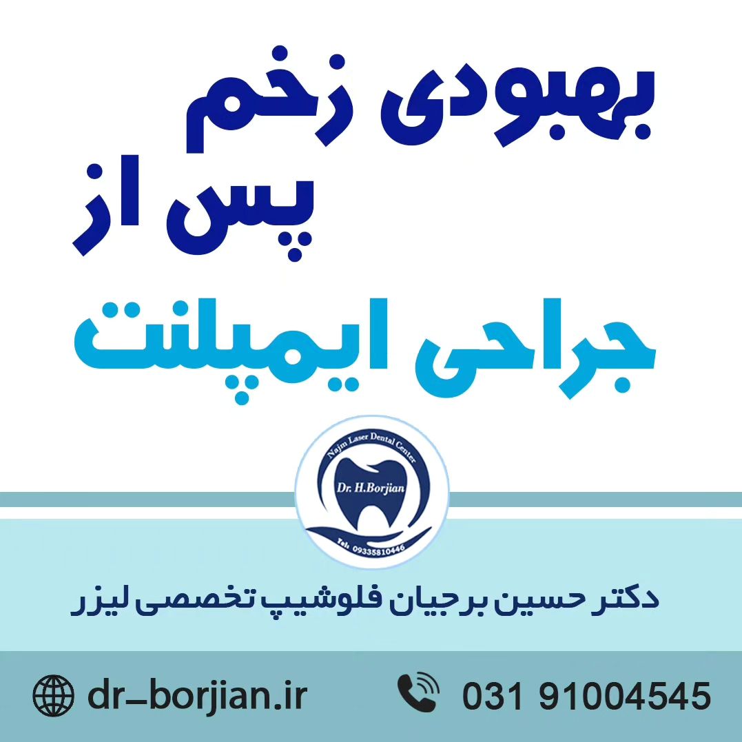 بهبودی زخم پس از جراحی ایمپلنت