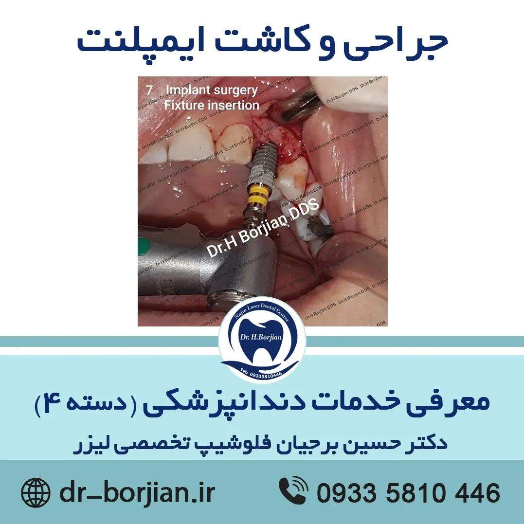 معرفی خدمات دندانپزشکی (دسته 4)