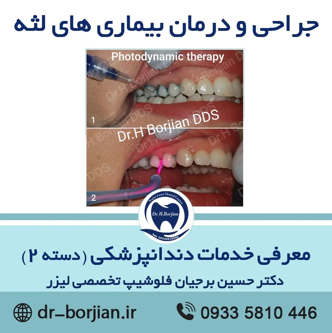 معرفی خدمات دندانپزشکی (دسته 2)