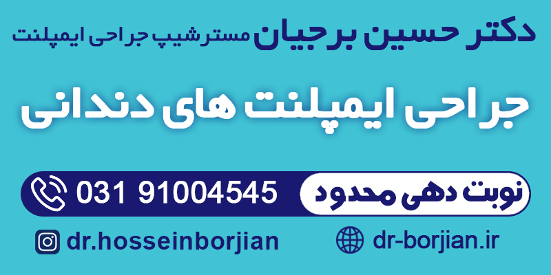 مسترشیپ جراحی ایمپلنت