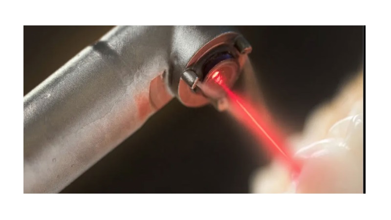 خدمات قابل ارائه در کلینیک لیزر دندانپزشکی اصفهان