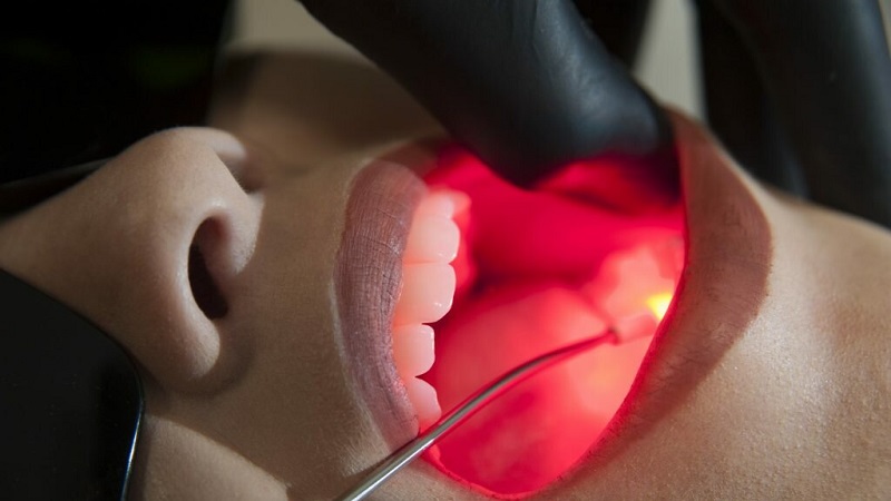 بهترین کلینیک لیزر دندانپزشکی اصفهان کجاست؟